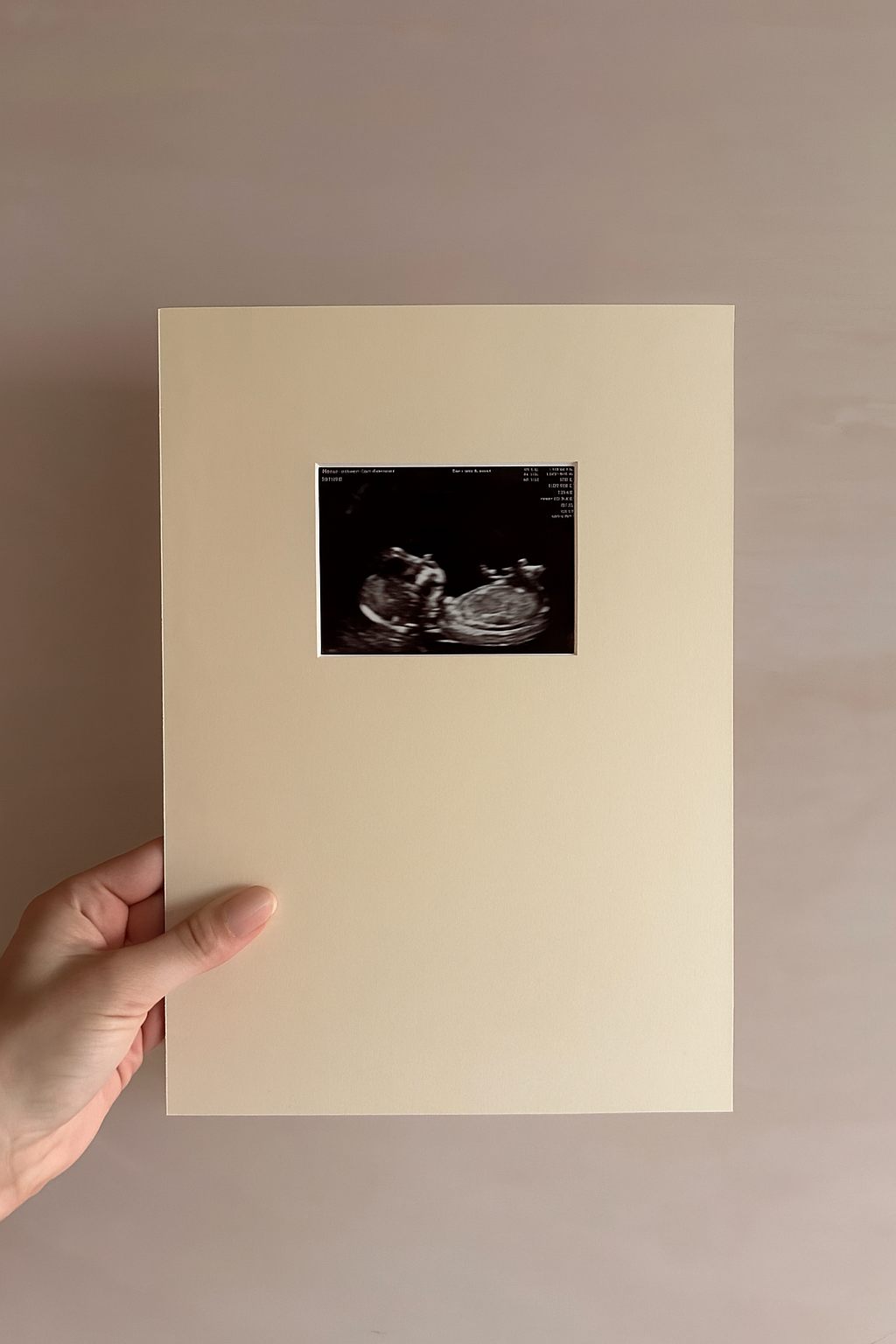 A4 Luxury Baby Scan Mount (With Colour Options)